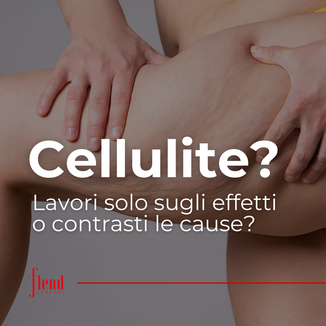 inestetismi della cellulite